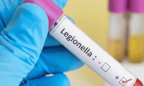 Sistemi anti legionella